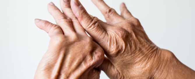 hands of a senior citizen with swollen knuckles and finger joints