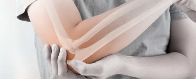 Person holding elbow in pain with imposed image of skeletal structure beneath