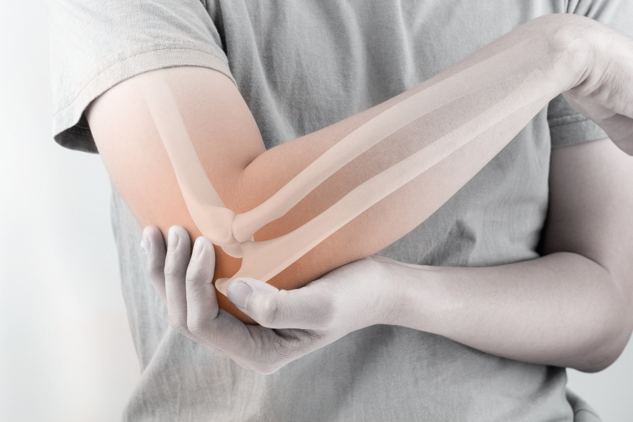 Person holding elbow in pain with imposed image of skeletal structure beneath