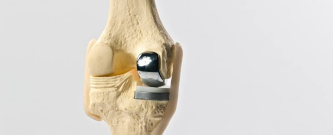 model of knee makoplasty