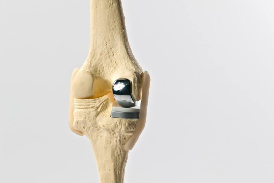model of knee makoplasty
