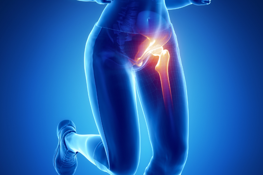 3D model of woman with vissible skeleton and a highlight of the hip joint
