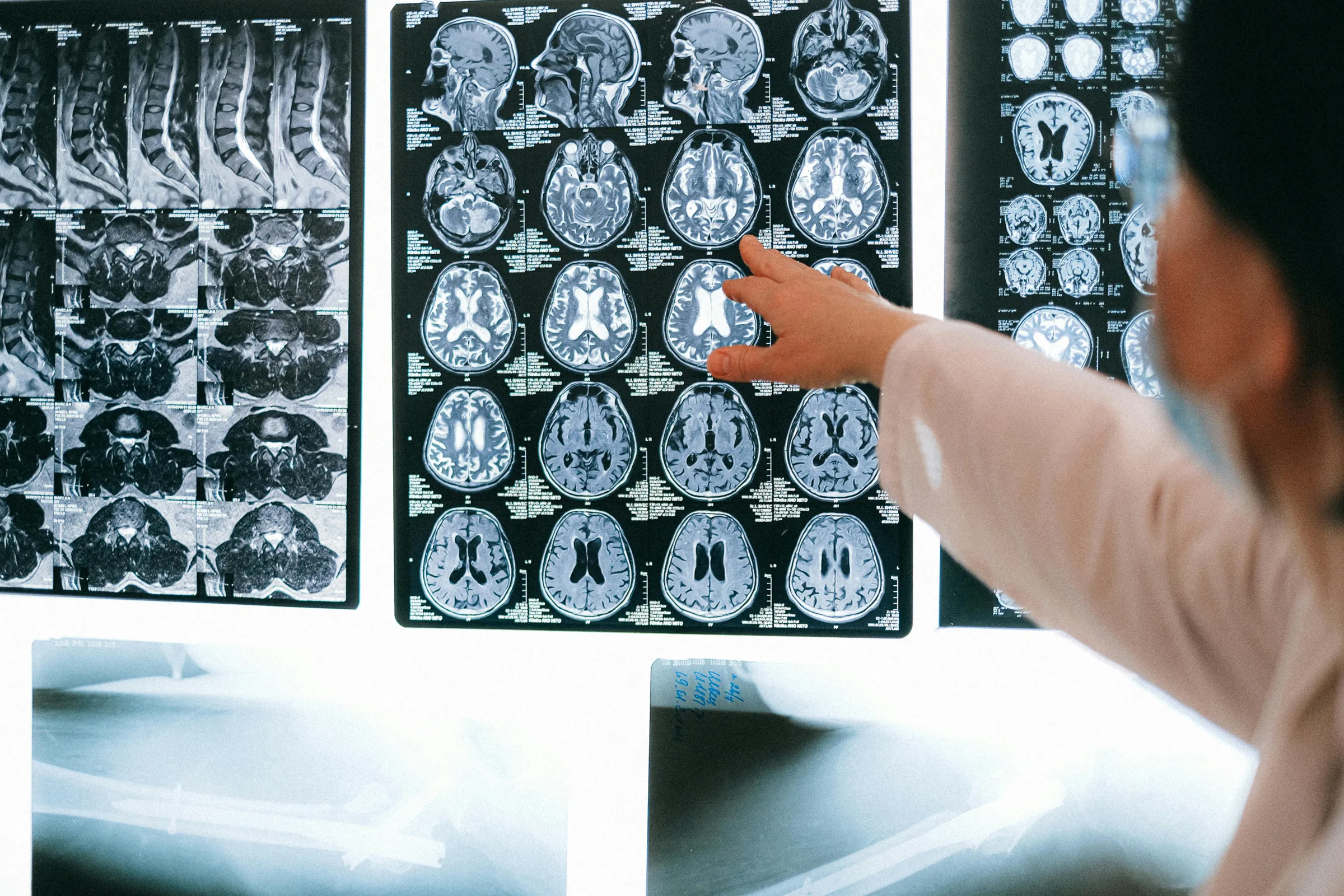 imaging_with_mri_and_xray X-Ray or MRI scans being held up by medical physicians